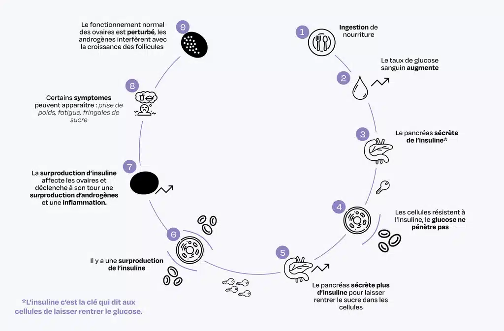 Les compléments SOVA Ovastart et Balance Tes Sucres et leur effet sur SOPK