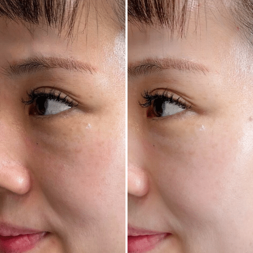 deux photos de mon visage prises à deux mois d’intervalle, dans les mêmes conditions de lumière naturelle, pour comparer honnêtement l’évolution de mon teint, de mes rougeurs et de mes ridules.
